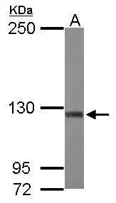 Sample (50 μg of whole cell lysate) A: mouse brain 5% SDS PAGE GTX112379 diluted at 1:2000 The HRP-conjugated anti-rabbit IgG antibody (GTX213110-01) was used to detect the primary antibody.