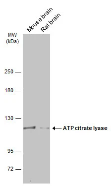 Various tissue extracts (50 μg) were separated by 5% SDS-PAGE, and the membrane was blotted with ATP citrate lyase antibody [N1N2], N-term (GTX112387) diluted at 1:5000. The HRP-conjugated anti-rabbit IgG antibody (GTX213110-01) was used to detect the primary antibody.