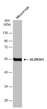 Whole cell extract (50 μg) was separated by 10% SDS-PAGE, and the membrane was blotted with ALDH3A1 antibody [N1C2] (GTX112391) diluted at 1:500. The HRP-conjugated anti-rabbit IgG antibody (GTX213110-01) was used to detect the primary antibody.