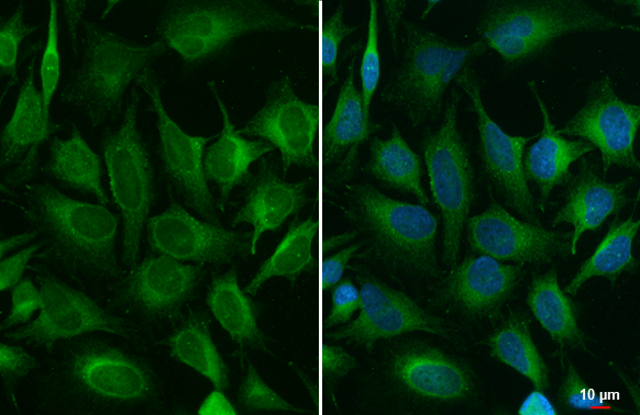 ACSL3 antibody detects ACSL3 protein at endoplasmic reticulum by immunofluorescent analysis. Sample: HeLa cells were fixed in 4% paraformaldehyde at RT for 15 min. Green: ACSL3 stained by ACSL3 antibody (GTX112431) diluted at 1:500.