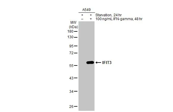 A549 whole cell extracts (50 μg) were separated by 10% SDS-PAGE, and the membrane was blotted with IFIT3 antibody (GTX112442) diluted at 1:1000. The HRP-conjugated anti-rabbit IgG antibody (GTX213110-01) was used to detect the primary antibody.