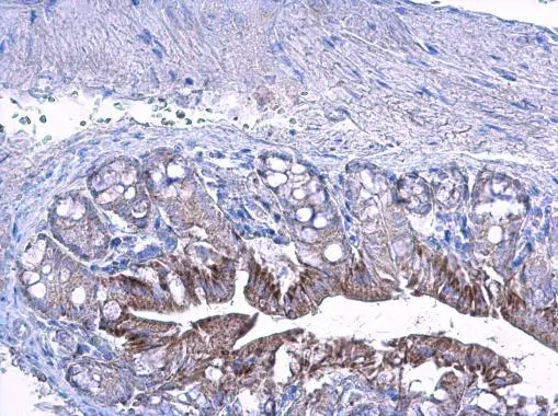 LETM1 antibody detects LETM1 protein at cytoplasm on mouse colon by immunohistochemical analysis. Sample: Paraffin-embedded mouse colon. LETM1 antibody (GTX112455) diluted at 1:500.
Antigen Retrieval: Trilogy? (EDTA based, pH 8.0) buffer, 15min LETM1 antibody detects LETM1 protein at cytoplasm on mouse colon by immunohistochemical analysis. Sample: Paraffin-embedded mouse colon. LETM1 antibody (GTX112455) diluted at 1:500.
Antigen Retrieval: Trilogy? (EDTA based, pH 8.0) buffer, 15min