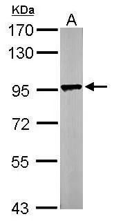 Sample (50 μg of whole cell lysate) A: Mouse brain 7.5% SDS PAGE GTX112455 diluted at 1:1000 The HRP-conjugated anti-rabbit IgG antibody (GTX213110-01) was used to detect the primary antibody. Sample (50 μg of whole cell lysate) A: Mouse brain 7.5% SDS PAGE GTX112455 diluted at 1:1000 The HRP-conjugated anti-rabbit IgG antibody (GTX213110-01) was used to detect the primary antibody.
