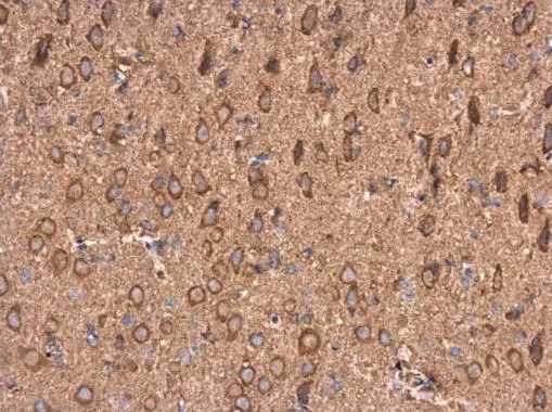 AMPD2 antibody [N3C3] detects AMPD2 protein at cytoplasm in rat brain by immunohistochemical analysis. Sample: Paraffin-embedded rat brain. AMPD2 antibody [N3C3] (GTX112483) diluted at 1:500. 
 Antigen Retrieval: Citrate buffer, pH 6.0, 15 min
