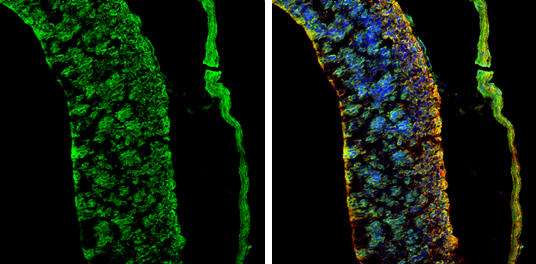 AMPD2 antibody [N3C3] detects AMPD2 protein by immunohistochemical analysis. Sample: Frozen-sectioned rat E13.5 brain. Green: AMPD2 stained by AMPD2 antibody [N3C3] (GTX112483) diluted at 1:250. Red: beta Tubulin 3/ Tuj1, stained by beta Tubulin 3/ Tuj1 antibody [GT1338] (GTX631831) diluted at 1:500. Blue: Fluoroshield with DAPI (GTX30920).