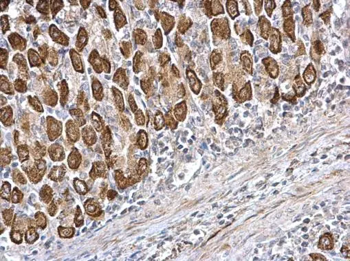 CDS1 antibody [C1C3] detects CDS1 protein at cytosol on mouse stomach by immunohistochemical analysis. Sample: Paraffin-embedded mouse stomach. CDS1 antibody [C1C3] (GTX112491) dilution: 1:500. 
 Antigen Retrieval: Trilogy? (EDTA based, pH 8.0) buffer, 15min
