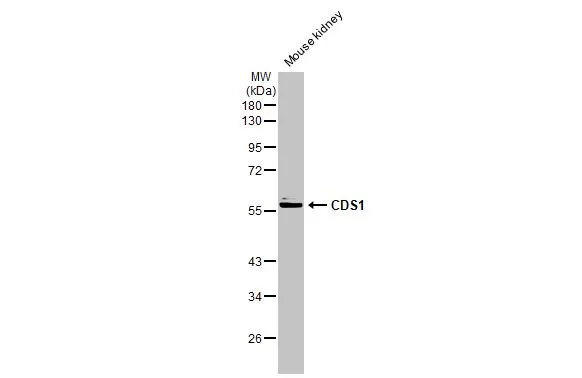 Mouse tissue extract (50 μg) was separated by 10% SDS-PAGE, and the membrane was blotted with CDS1 antibody [C1C3] (GTX112491) diluted at 1:1000. The HRP-conjugated anti-rabbit IgG antibody (GTX213110-01) was used to detect the primary antibody.