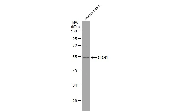 Mouse tissue extract (50 μg) was separated by 10% SDS-PAGE, and the membrane was blotted with CDS1 antibody [C1C3] (GTX112491) diluted at 1:10000. The HRP-conjugated anti-rabbit IgG antibody (GTX213110-01) was used to detect the primary antibody.