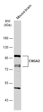 Mouse tissue extract (50 μg) was separated by 7.5% SDS-PAGE, and the membrane was blotted with CNGA2 antibody [C1C3] (GTX112498) diluted at 1:1000. The HRP-conjugated anti-rabbit IgG antibody (GTX213110-01) was used to detect the primary antibody.