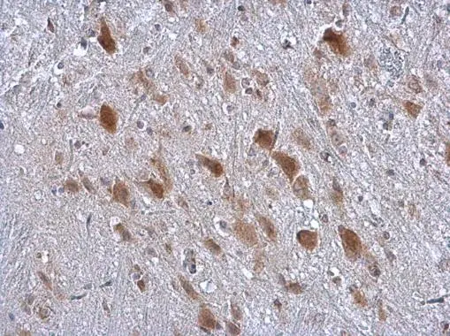 Kinectin 1A antibody [C2C3], C-term detects Kinectin 1A protein at cytoplasm in mouse brain by immunohistochemical analysis. Sample: Paraffin-embedded mouse brain. Kinectin 1A antibody [C2C3], C-term (GTX112532) diluted at 1:500. 
 Antigen Retrieval: Citrate buffer, pH 6.0, 15 min