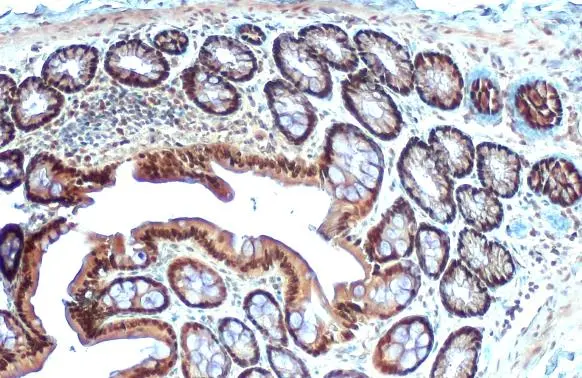 MAT1A + MAT2A antibody [N1C2] detects MAT1A + MAT2A protein at cytoplasm and nucleus by immunohistochemical analysis. Sample: Paraffin-embedded rat colon. MAT1A + MAT2A stained by MAT1A + MAT2A antibody [N1C2] (GTX112535) diluted at 1:500. Antigen Retrieval: Citrate buffer, pH 6.0, 15 min