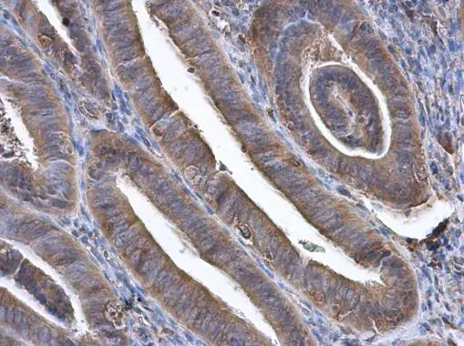 GBP3 antibody [N1C1] detects GBP3 protein at cytoplasm in human endometrium by immunohistochemical analysis. Sample: Paraffin-embedded human endometrium. GBP3 antibody [N1C1] (GTX112554) diluted at 1:500. 
 Antigen Retrieval: Citrate buffer, pH 6.0, 15 min