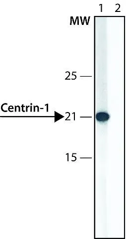 WB analysis of HEK-293T cells overexpressing human centrin-1 using GTX11257 Centrin 1 antibody. Lane 1 : Antibody 0.3 ug/mL Lane 2 : Antibody 0.3 ug/mL + centrin1 immunizing peptide (human,157-172)