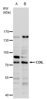 Coilin antibody detects Coilin protein by Western blot analysis. A. 30 μg HepG2 whole cell extract B. 30 μg HepG2 nuclear extract 7.5 % SDS-PAGE Coilin antibody (GTX112570) dilution: 1:1000 Coilin antibody detects Coilin protein by Western blot analysis. A. 30 μg HepG2 whole cell extract B. 30 μg HepG2 nuclear extract 7.5 % SDS-PAGE Coilin antibody (GTX112570) dilution: 1:1000