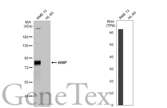 Various whole cell extracts (30 μg) were separated by 7.5% SDS-PAGE, and the membrane was blotted with HHIP antibody [N3C2], Internal (GTX112584) diluted at 1:1000. The HRP-conjugated anti-rabbit IgG antibody (GTX213110-01) was used to detect the primary antibody. Corresponding RNA expression data for the same cell lines are based on Human Protein Atlas program.