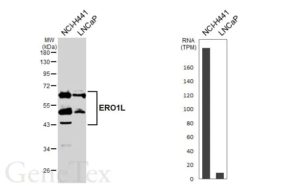Various whole cell extracts (30 μg) were separated by 10% SDS-PAGE, and the membrane was blotted with ERO1L antibody (GTX112589) diluted at 1:1000. The HRP-conjugated anti-rabbit IgG antibody (GTX213110-01) was used to detect the primary antibody. Corresponding RNA expression data for the same cell lines are based on Human Protein Atlas program.