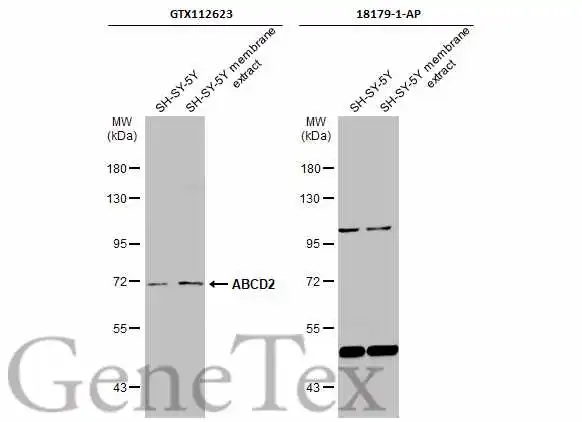 SH-SY5Y whole cell and membrane extracts (30 μg) were separated by 7.5% SDS-PAGE, and the membranes were blotted with ABCD2 antibody [N3C2], Internal (GTX112623) diluted at 1:500 and competitor's antibody (18179-1-AP) diluted at 1:500. The HRP-conjugated anti-rabbit IgG antibody (GTX213110-01) was used to detect the primary antibody. *The competitor is not affiliated with GeneTex and does not endorse this product.