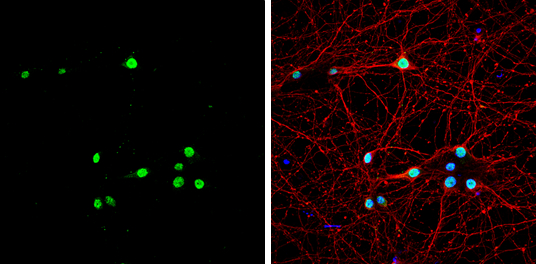 Muscleblind-like 1 antibody detects Muscleblind-like 1 protein by immunofluorescent analysis. Sample: DIV9 rat E18 primary hippocampal neuron cells were fixed in 4% paraformaldehyde at RT for 15 min. Green: Muscleblind-like 1 stained by Muscleblind-like 1 antibody (GTX112624) diluted at 1:500. Red: beta Tubulin 3/ Tuj1, stained by beta Tubulin 3/ Tuj1 antibody [GT11710] (GTX631836) diluted at 1:500. Blue: Fluoroshield with DAPI (GTX30920).