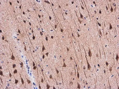 APP antibody