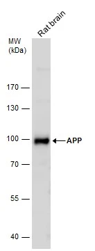 Various whole cell extracts (30 ug) were separated by 7.5% SDS-PAGE,and the membrane was blotted with APP antibody (GTX112677) diluted at 1:500.