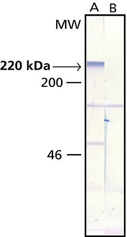 WB analysis of rat brain extract using GTX11268 MAP2 antibody[AP-20]. Lane A : Antibody dilution 1:500 Lane B : Secondary antibody only