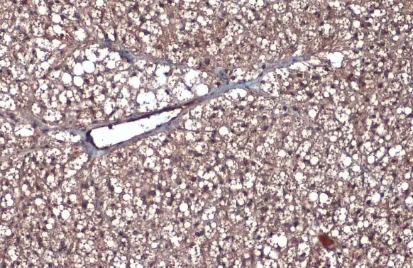 CD105 antibody [N1N3] detects CD105 protein at cell membrane and cytoplasm by immunohistochemical analysis. Sample: Paraffin-embedded mouse brown adipocyte. CD105 stained by CD105 antibody [N1N3] (GTX112684) diluted at 1:500. Antigen Retrieval: Citrate buffer, pH 6.0, 15 min