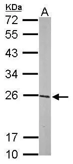 Sample (50 μg of whole cell lysate) A: mouse brain 12% SDS PAGE GTX112695 diluted at 1:1000 The HRP-conjugated anti-rabbit IgG antibody (GTX213110-01) was used to detect the primary antibody.