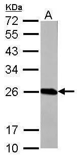 GSTP1 antibody detects GSTP1 protein by western blot analysis. A. 50 μg Rat brain lysate/extract 12% SDS-PAGE GSTP1 antibody (GTX112695) dilution: 1:1000 The HRP-conjugated anti-rabbit IgG antibody (GTX213110-01) was used to detect the primary antibody. GSTP1 antibody detects GSTP1 protein by western blot analysis. A. 50 μg Rat brain lysate/extract 12% SDS-PAGE GSTP1 antibody (GTX112695) dilution: 1:1000 The HRP-conjugated anti-rabbit IgG antibody (GTX213110-01) was used to detect the primary antibody.