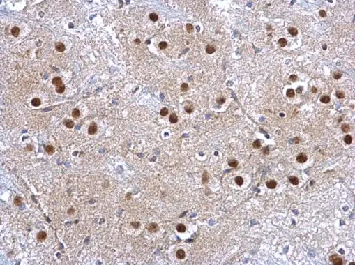 GSTP1 antibody detects GSTP1 protein at nucleus on mouse brain stem by immunohistochemical analysis. Sample: Paraffin-embedded mouse brain stem. GSTP1 antibody (GTX112695) dilution: 1:500.
Antigen Retrieval: Trilogy? (EDTA based, pH 8.0) buffer, 15min GSTP1 antibody detects GSTP1 protein at nucleus on mouse brain stem by immunohistochemical analysis. Sample: Paraffin-embedded mouse brain stem. GSTP1 antibody (GTX112695) dilution: 1:500.
Antigen Retrieval: Trilogy? (EDTA based, pH 8.0) buffer, 15min