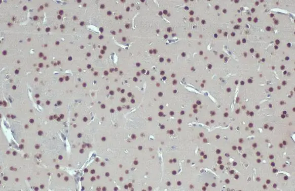 GSTP1 antibody detects GSTP1 protein at cytoplasm and nucleus by immunohistochemical analysis. Sample: Paraffin-embedded mouse brain. GSTP1 stained by GSTP1 antibody (GTX112695) diluted at 1:500. Antigen Retrieval: Citrate buffer, pH 6.0, 15 min GSTP1 antibody detects GSTP1 protein at cytoplasm and nucleus by immunohistochemical analysis. Sample: Paraffin-embedded mouse brain. GSTP1 stained by GSTP1 antibody (GTX112695) diluted at 1:500. Antigen Retrieval: Citrate buffer, pH 6.0, 15 min