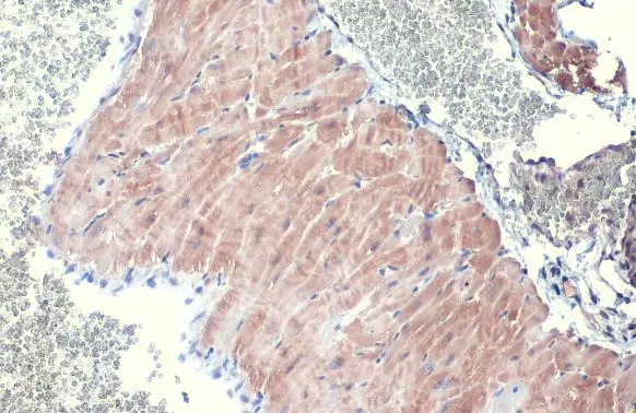 ANP antibody [N1C3]