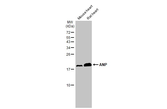 Various tissue extracts (50 μg) were separated by 15% SDS-PAGE, and the membrane was blotted with ANP antibody [N1C3] (GTX112698) diluted at 1:2000. The HRP-conjugated anti-rabbit IgG antibody (GTX213110-01) was used to detect the primary antibody.