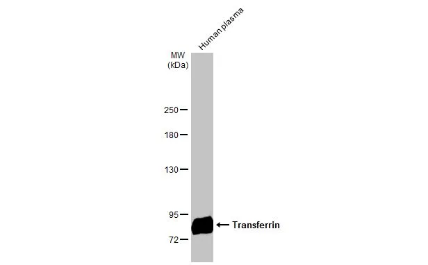 Transferrin antibody [N3C2], Internal