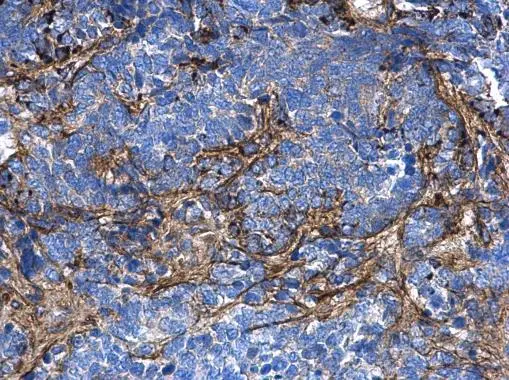 Anti-COL1A1 antibody [N1N2], N-term (GTX112731) | GeneTex