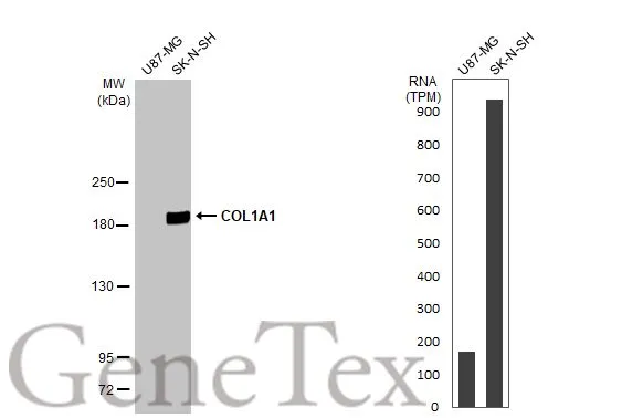 Anti-COL1A1 antibody [N1N2], N-term (GTX112731) | GeneTex
