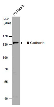 Rat tissue extract (50 μg) was separated by 7.5% SDS-PAGE, and the membrane was blotted with N-Cadherin antibody [N2C1], Internal (GTX112733) diluted at 1:1000.
