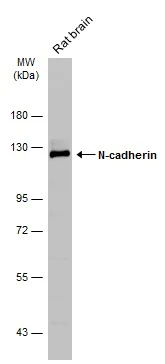 Rat tissue extract (50 μg) was separated by 7.5% SDS-PAGE, and the membrane was blotted with N-cadherin antibody (GTX112734) diluted at 1:1000. The HRP-conjugated anti-rabbit IgG antibody (GTX213110-01) was used to detect the primary antibody. Rat tissue extract (50 μg) was separated by 7.5% SDS-PAGE, and the membrane was blotted with N-cadherin antibody (GTX112734) diluted at 1:1000. The HRP-conjugated anti-rabbit IgG antibody (GTX213110-01) was used to detect the primary antibody.