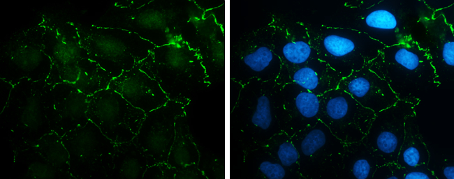 N-Cadherin antibody [N1N3] detects N-Cadherin protein at cell membrane by immunofluorescent analysis. Sample: NT2D1 cells were fixed in 4% paraformaldehyde at RT for 15 min. Green: N-Cadherin stained by N-Cadherin antibody [N1N3] (GTX112734) diluted at 1:500. Blue: Hoechst 33342 staining.