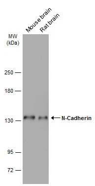 Various tissue extracts (50 μg) were separated by 5% SDS-PAGE, and the membrane was blotted with N-Cadherin antibody [N1N3] (GTX112734) diluted at 1:1000. The HRP-conjugated anti-rabbit IgG antibody (GTX213110-01) was used to detect the primary antibody.