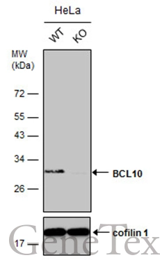 Wild-type (WT) and BCL10 knockout (KO) HeLa cell extracts (30 μg) were separated by 12% SDS-PAGE, and the membrane was blotted with BCL10 antibody (GTX112744) diluted at 1:2500. The HRP-conjugated anti-rabbit IgG antibody (GTX213110-01) was used to detect the primary antibody.