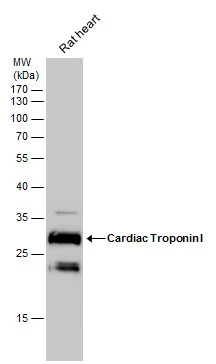 Rat tissue extract (50 μg) was separated by 12% SDS-PAGE, and the membrane was blotted with Cardiac Troponin I antibody [N1C3-2] (GTX112770) diluted at 1:10000.