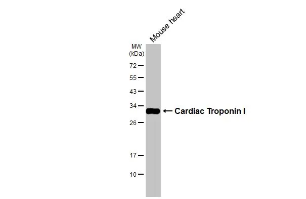 Mouse tissue extract (50 μg) was separated by 12% SDS-PAGE, and the membrane was blotted with Cardiac Troponin I antibody [N1C3-2] (GTX112770) diluted at 1:5000. The HRP-conjugated anti-rabbit IgG antibody (GTX213110-01) was used to detect the primary antibody.