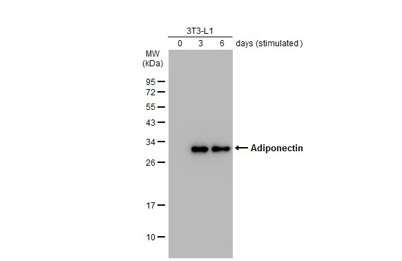 Adiponectin antibody detects Adiponectin protein by western blot analysis. Human tissue extracts (30 ug) was separated by 12% SDS-PAGE,and the membrane was blotted with Adiponectin antibody (GTX112777) diluted at 1:500.