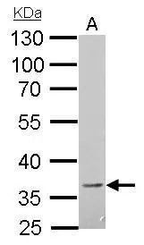 CD272 antibody detects BTLA protein by Western blot analysis. A. 30 ug A375 whole cell lysate/extract 10 % SDS-PAGE CD272 antibody (GTX112783) dilution: 1:1000