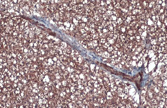 UCP1 antibody detects UCP1 protein at cytoplasm by immunohistochemical analysis. Sample: Paraffin-embedded mouse brown adipocyte. UCP1 stained by UCP1 antibody (GTX112784) diluted at 1:500. Antigen Retrieval: Citrate buffer, pH 6.0, 15 min
