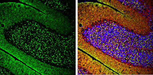 Anti-alpha Synuclein antibody (GTX112799) | GeneTex