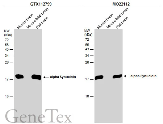 Anti-alpha Synuclein antibody (GTX112799) | GeneTex