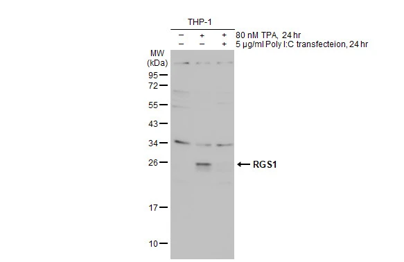 Untreated (–) and treated (+) THP-1 whole cell extract (30 μg) were separated by 12% SDS-PAGE, and the membrane was blotted with RGS1 antibody (GTX112803) diluted at 1:1000. The HRP-conjugated anti-rabbit IgG antibody (GTX213110-01) was used to detect the primary antibody.