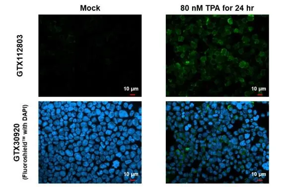 RGS1 antibody detects RGS1 protein at cell membrane by immunofluorescent analysis. Sample: Mock and treated THP-1 cells were fixed in 4% paraformaldehyde at RT for 15 min. Green: RGS1 stained by RGS1 antibody (GTX112803) diluted at 1:500. Blue: Fluoroshield with DAPI (GTX30920).