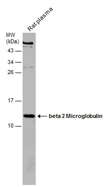 Anti-beta 2 Microglobulin antibody (GTX112815) | GeneTex